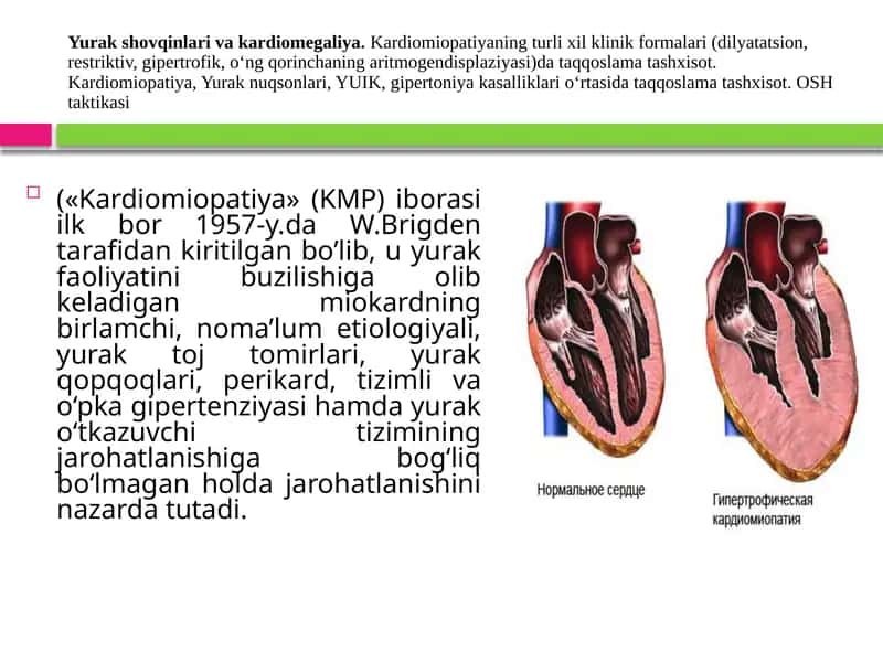 Yurak shovqinlari va kardiomegaliya. Kardiomiopatiyaning turli xil klinik formalari (dilyatatsion, restriktiv, gipertrofik, o‘ng qorinchaning aritmogendisplaziyasi)da taqqoslama tashxisot. Kardiomiopatiya, Yurak nuqsonlari, YUIK, gipertoniya kasalliklari o‘rtasida taqqoslama tashxisot. OSH taktikasi 1