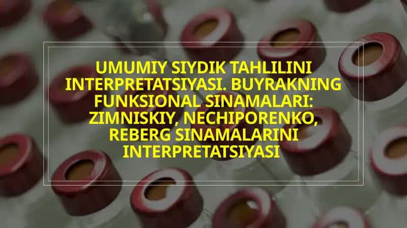 siydik tahlili. zimnitskiy, nechiporenko, reberg sinamalari 1