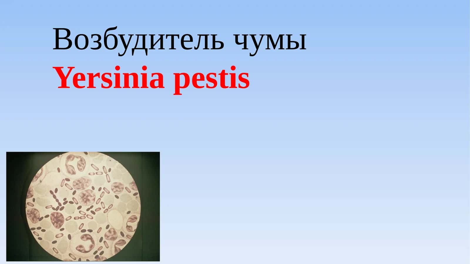 [Возбудитель чумы] 1