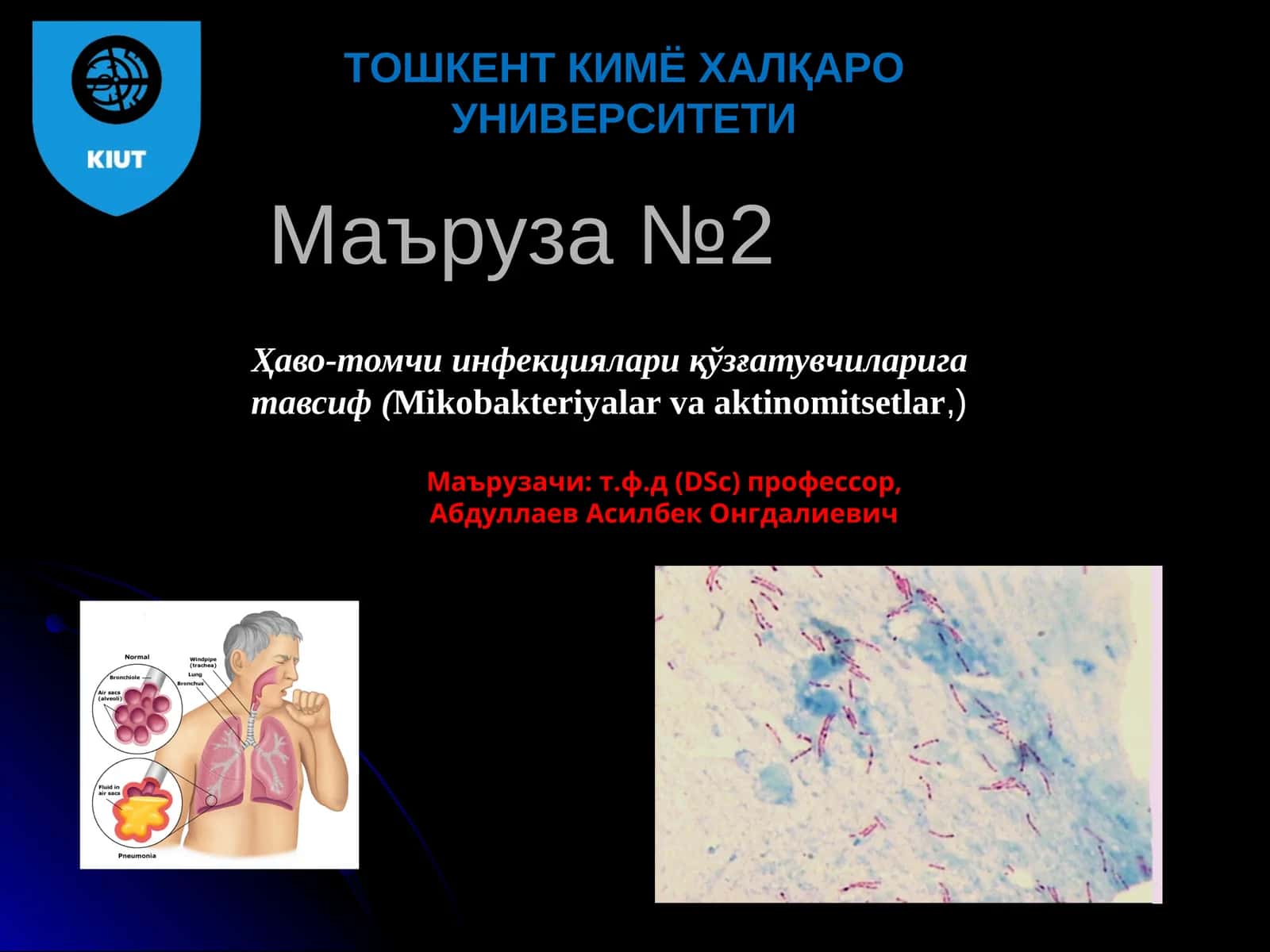 Ҳаво-томчи инфекциялари қўзғатувчиларига тавсиф (Mikobakteriyalar va aktinomitsetlar) 1