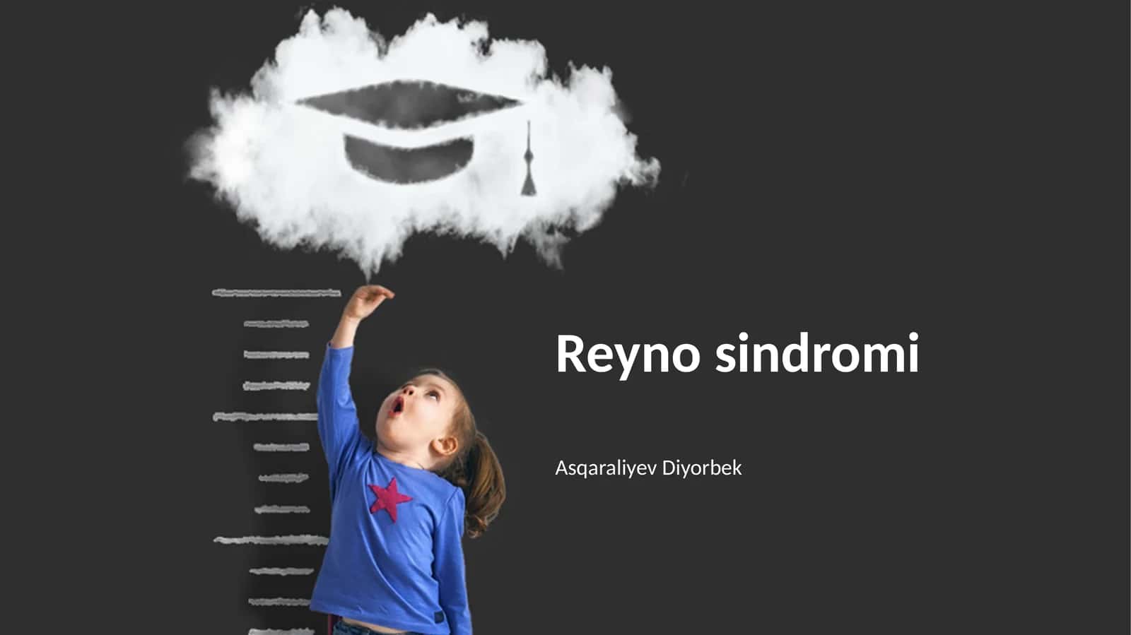 Raynaud Sindromi 1