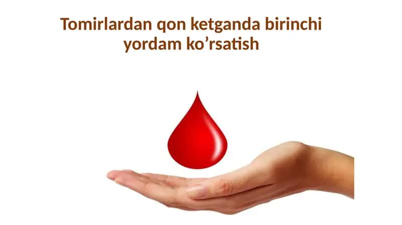 Arterial qonketish 1
