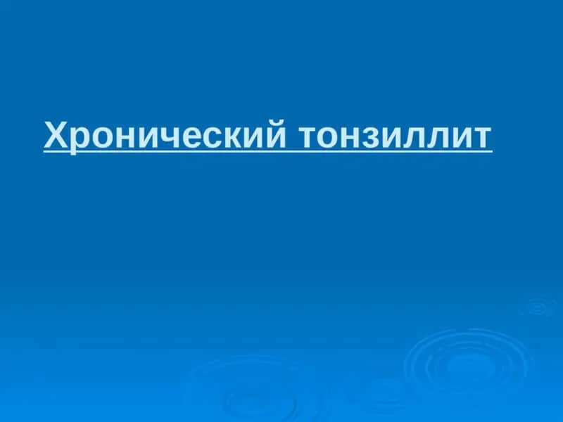 Хронический тонзиллит