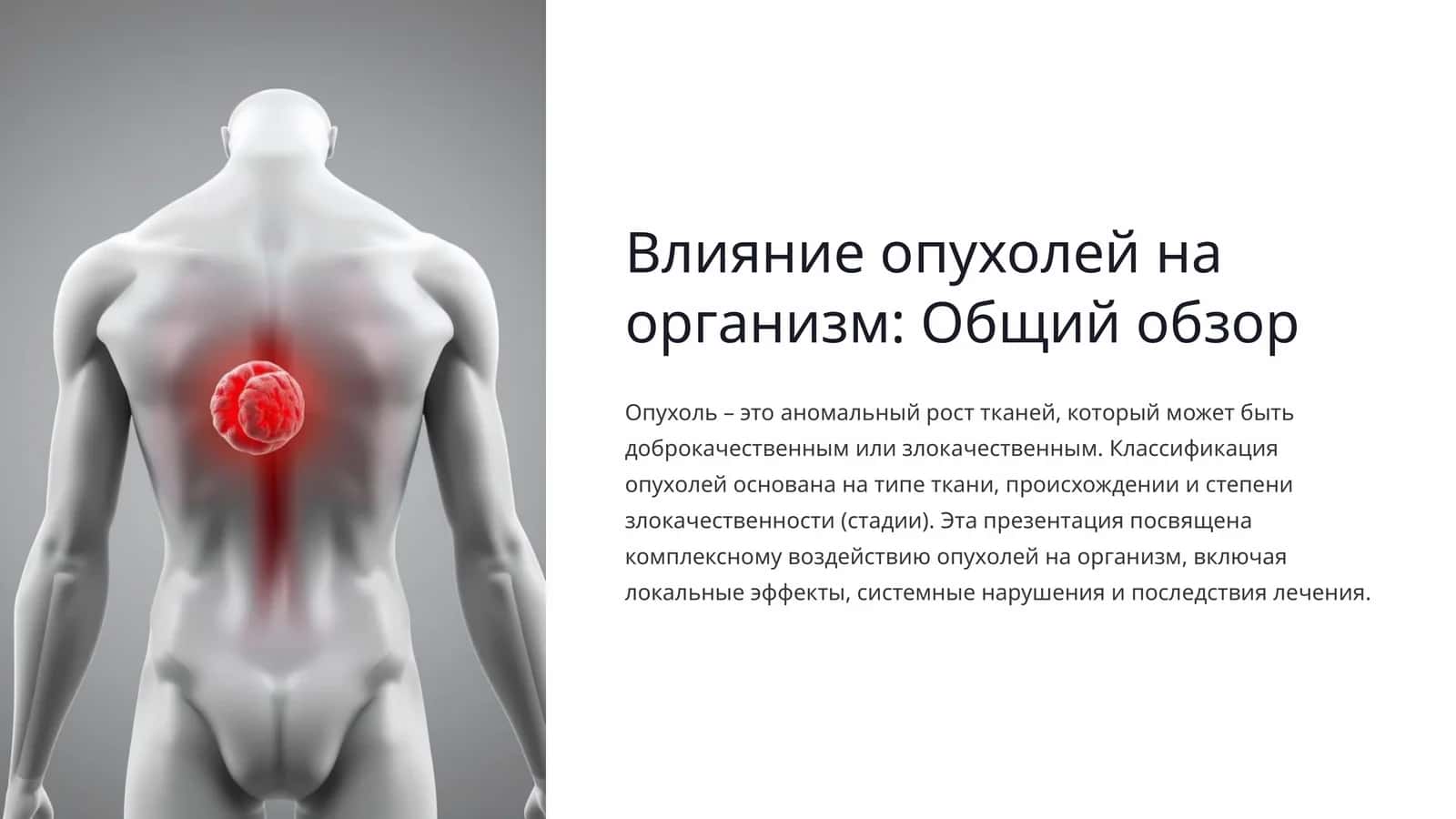 Влияние опухолей на организм: Общий обзор 1