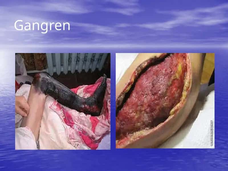 Gangren 1
