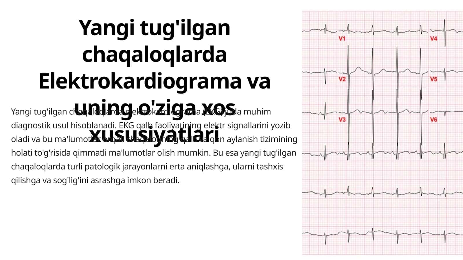 Yangi tug'ilgan chaqaloqlarda Elektrokardiograma va uning o'ziga xos xususiyatlari 1