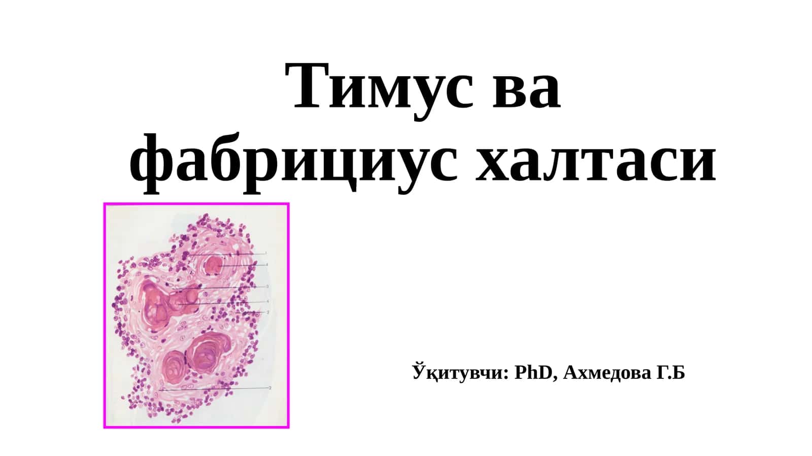 Тимус вафабрицияси 1