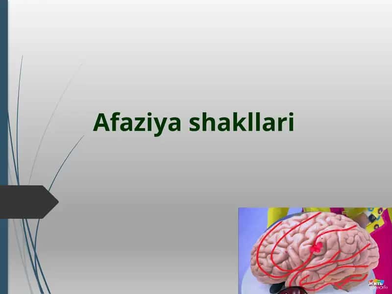 Аfaziya klassifikatsiyalari 1