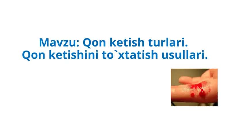 Qon ketish turlari. Qon ketishini to`xtatish usullari. 1