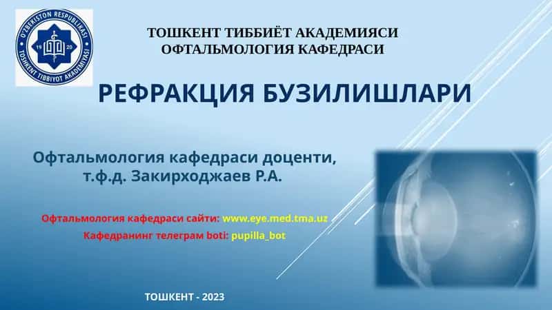 РефракциЯбузилишлари 1