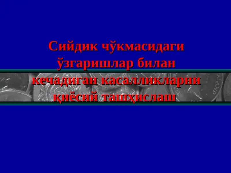 Siydik cho'kmasi 1