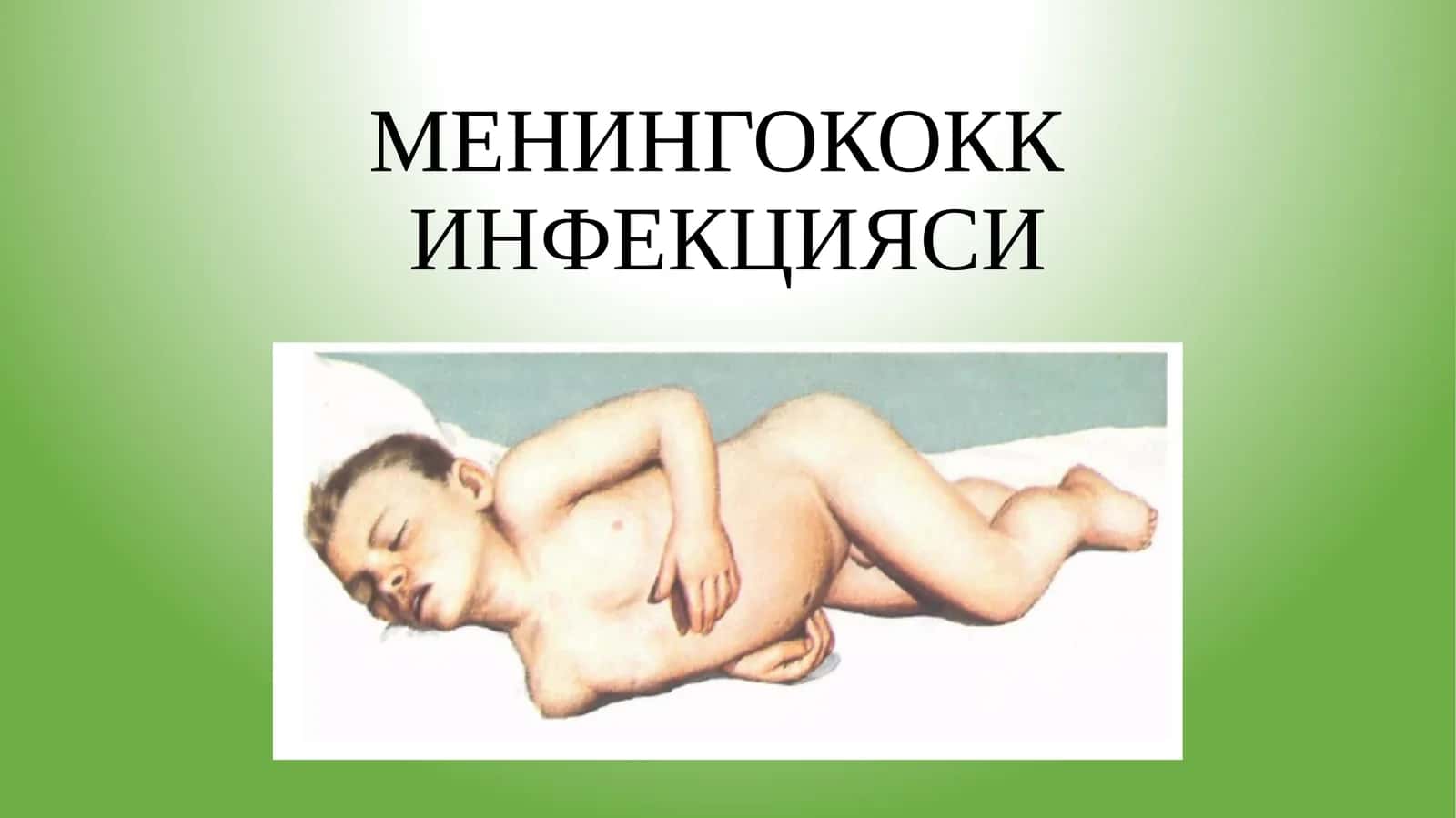 МЕНИНГОКОКК ИНФЕКЦИЯСИ 1
