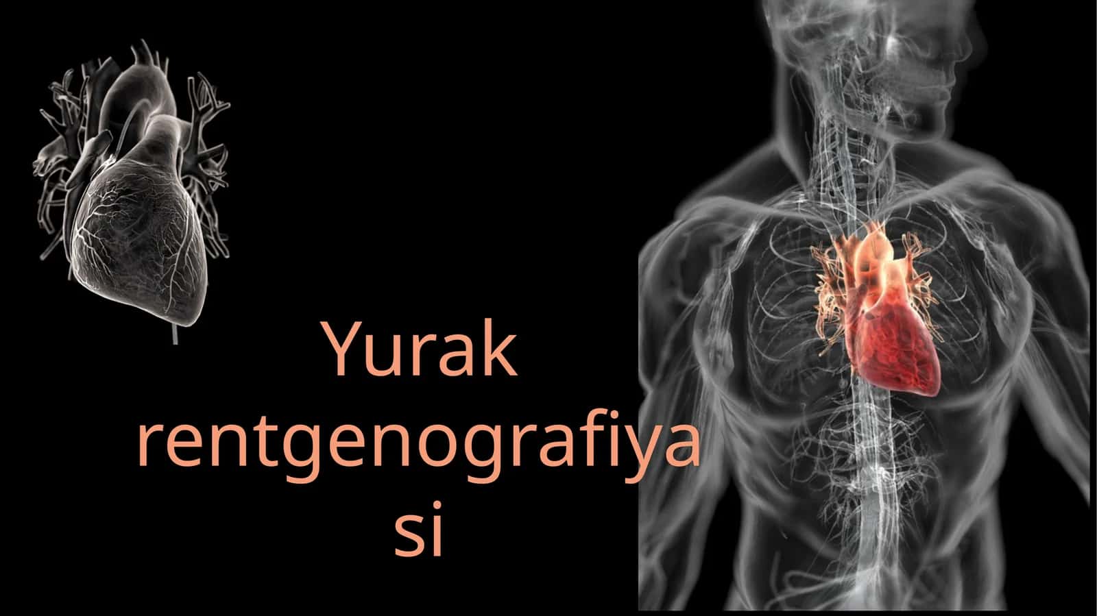 Yurak rentgenografiyasi 1