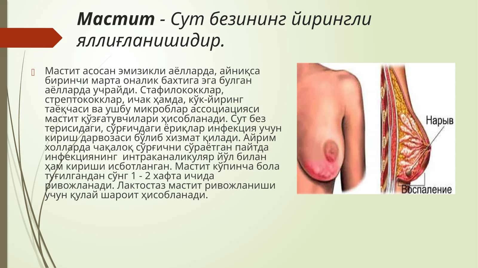 Мастит-Сутбезининг йирингли яллиғланиши 1