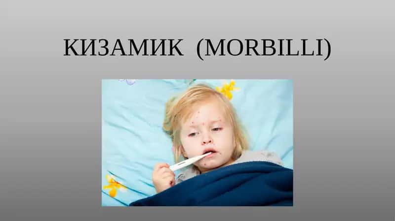 Қизамиқ (MORBILLI) 1