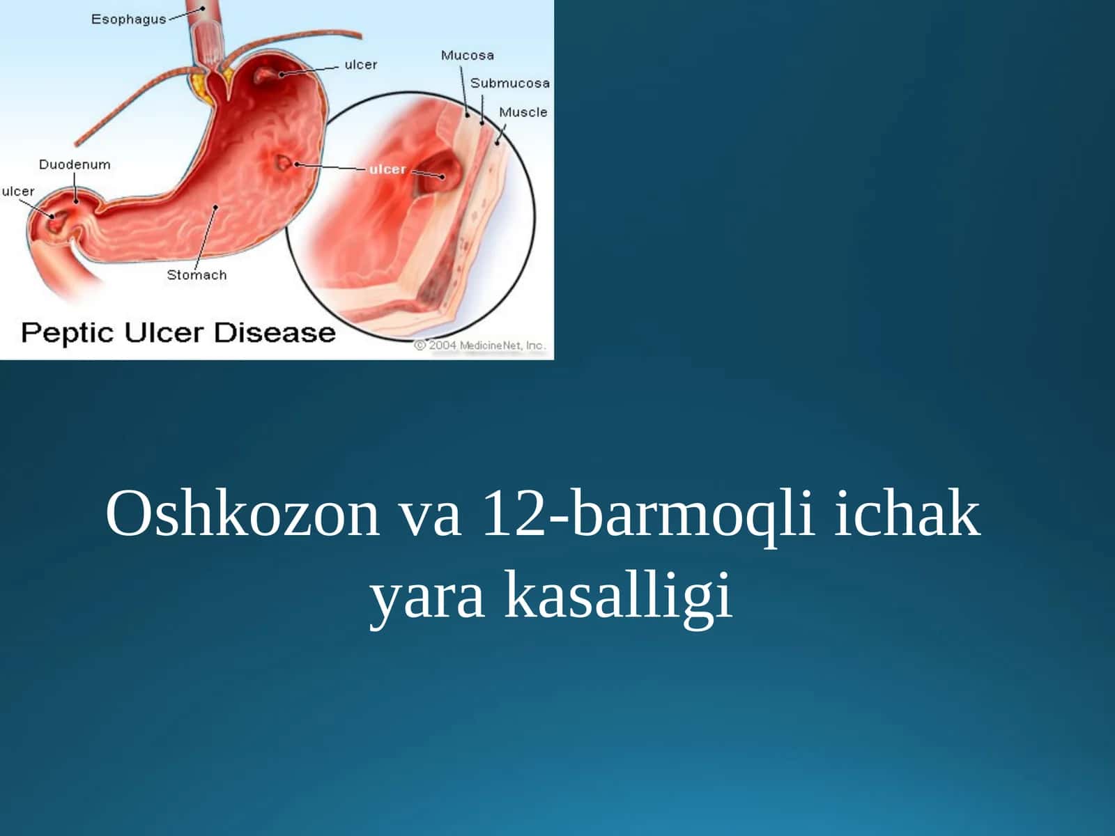 Oshkozonva12-barmoqliichak 1