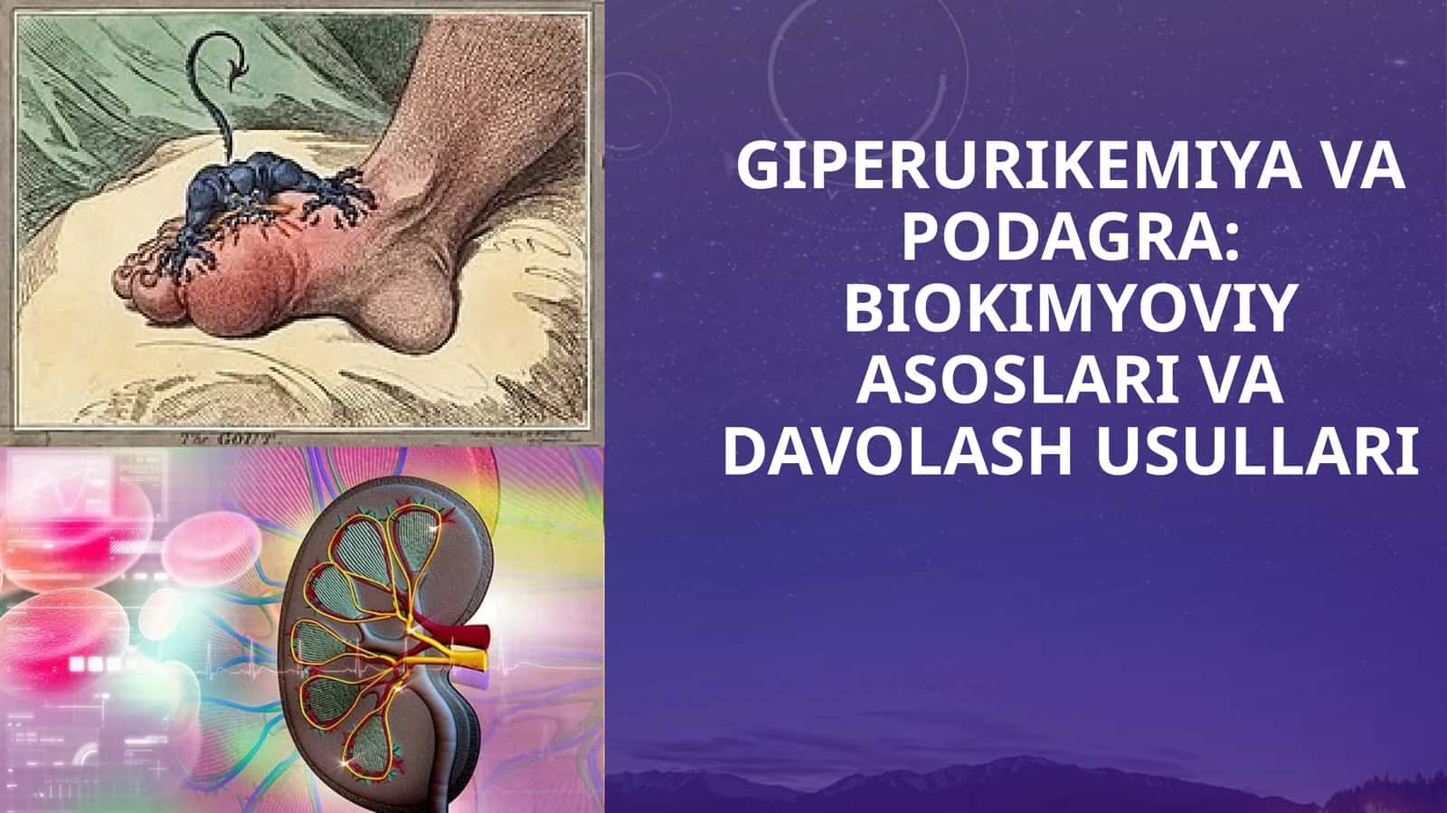 GIPERURIKEMIYA VA PODAGRA BIOKIMYOVIY ASOSLARI VA DAVOLASH USULLARI 1