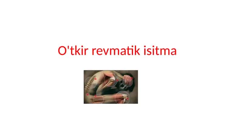 O'tkir revmatik isitma 1