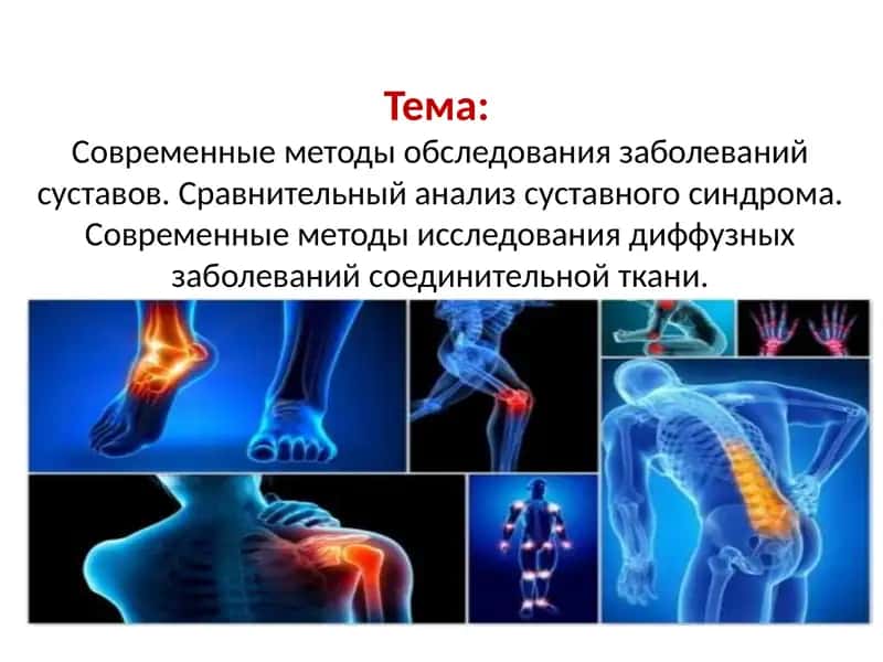 Современные методы обследования заболеваний суставов. Сравнительный анализ суставного синдрома. Современные методы исследования диффузных заболеваний соединительной ткани. 1