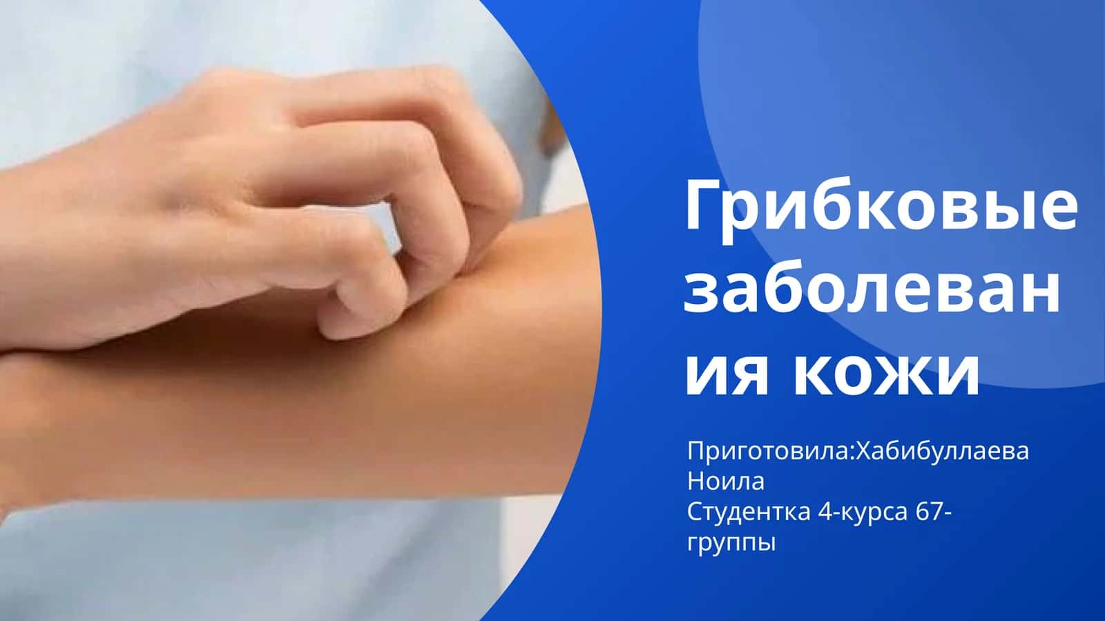 Грибковые заболевания кожи 1