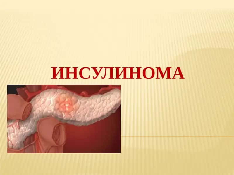 INSULINOMA 1