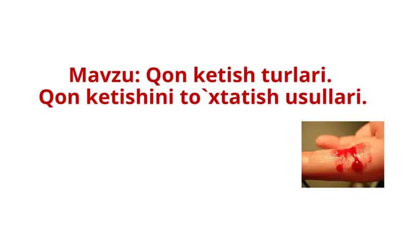 Qon ketishi. Qon ketishini to`xtatish usullari 1