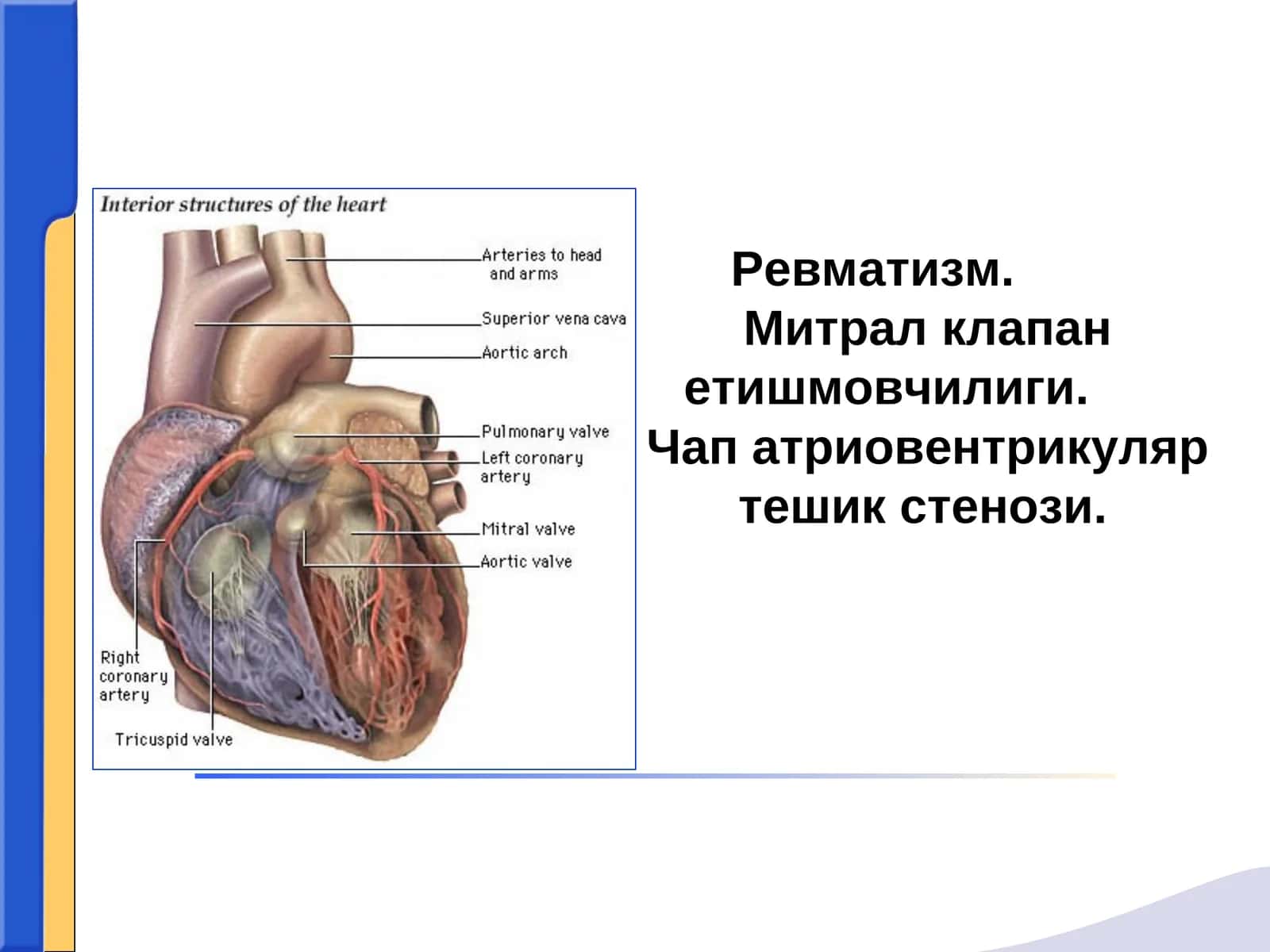 Ревматизм (Сокольский-Буйо касаллиги) 1