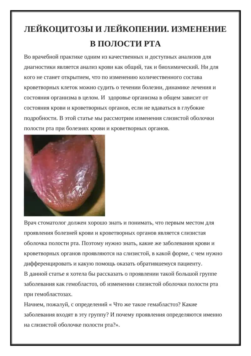Гемобластозы 1