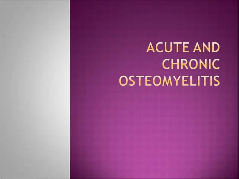 ACUTE AND CHRONIC OSTEOMYELITIS 1