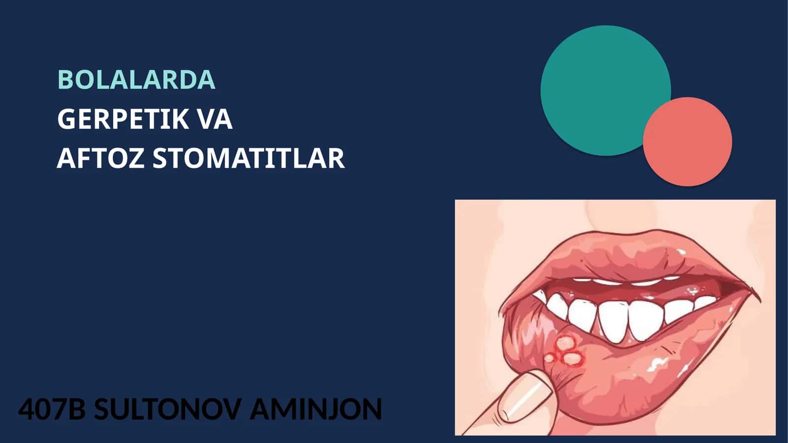 BOLALARDA GERPETIK VA AFTOZ STOMATITLAR 1