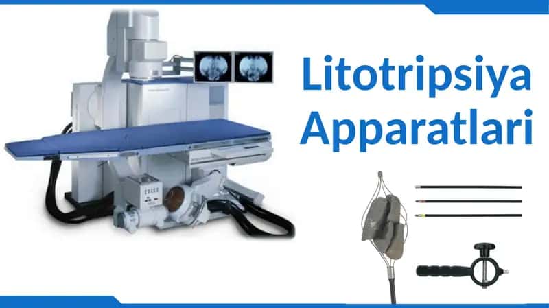 LitotripsiyaApparatlari 1