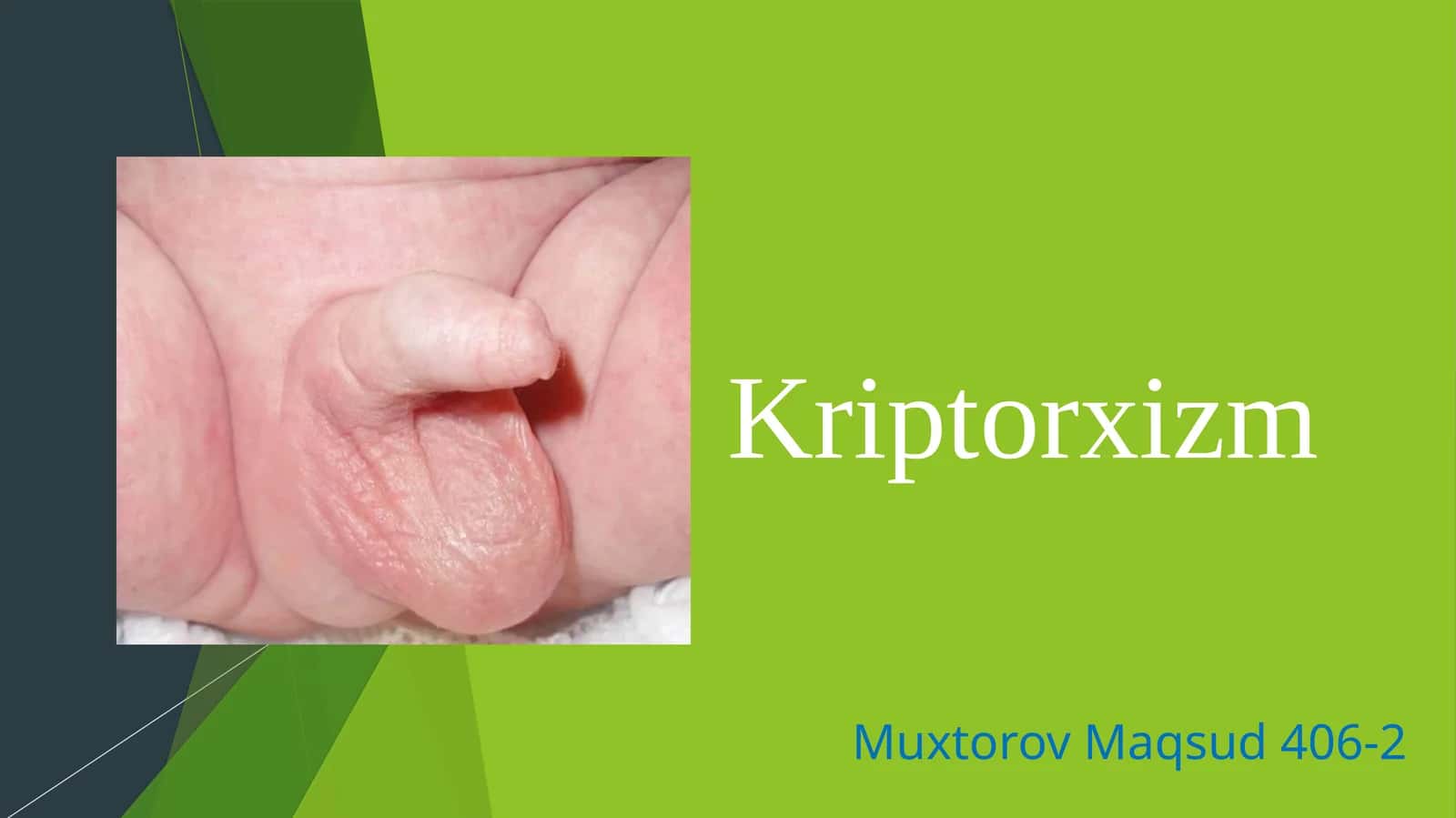 Kriptorxizm 1