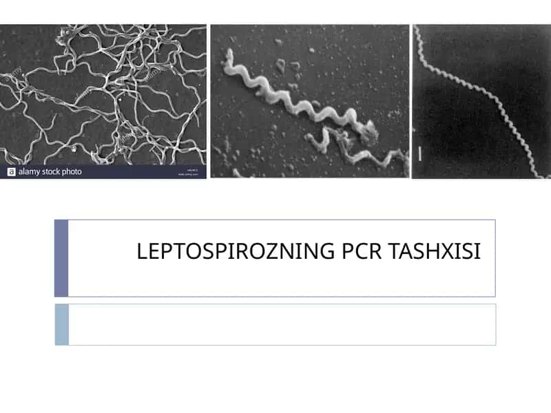 LEPTOSPIROZNING PCR TASHXISI 1