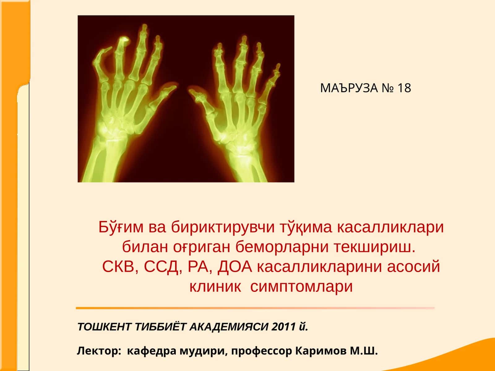 Системали кизил волчанка 1
