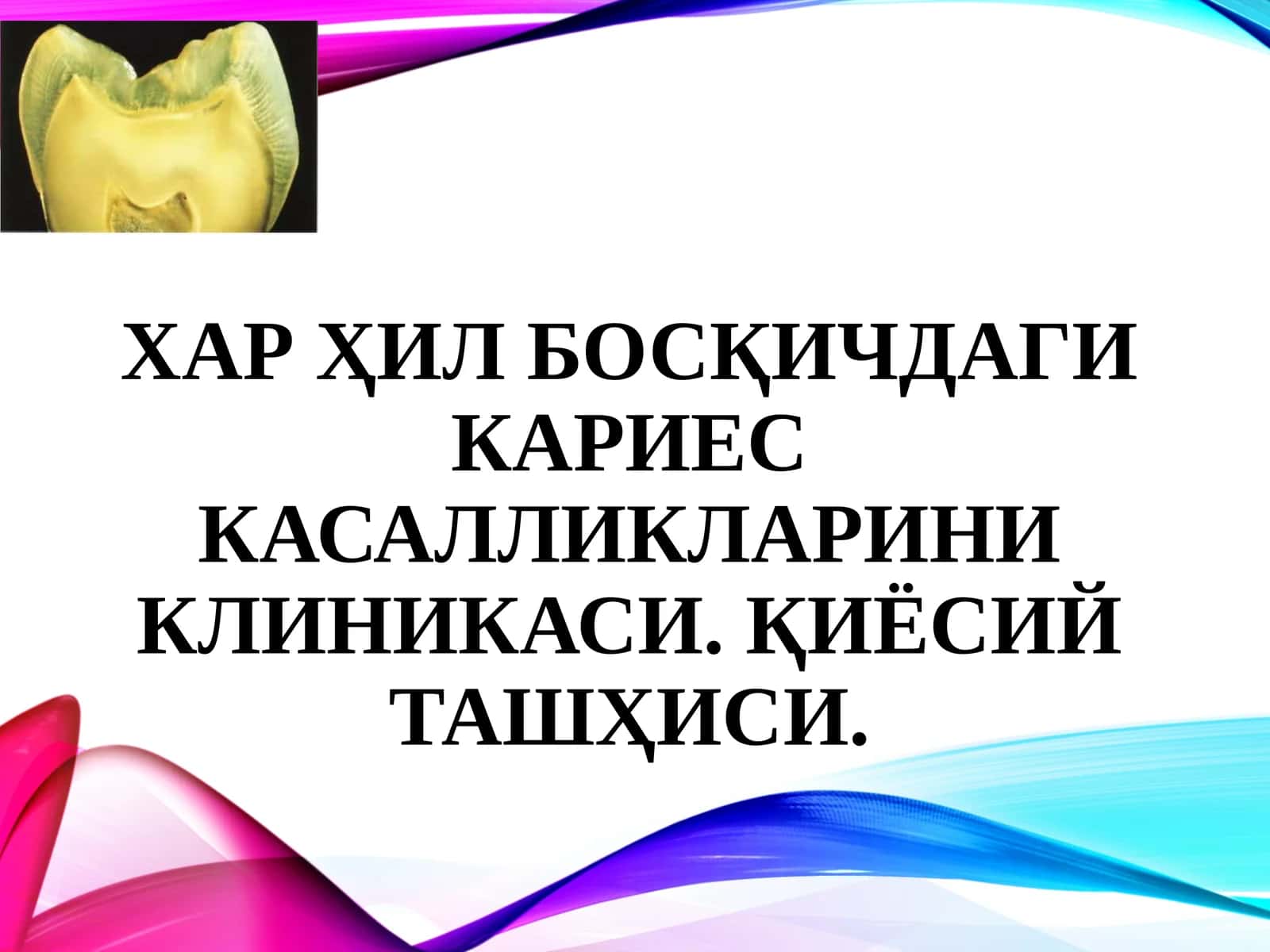 Хар ҳил босқичдаги кариес касалликларини клиникаси. Қиёсий ташҳиси. 1