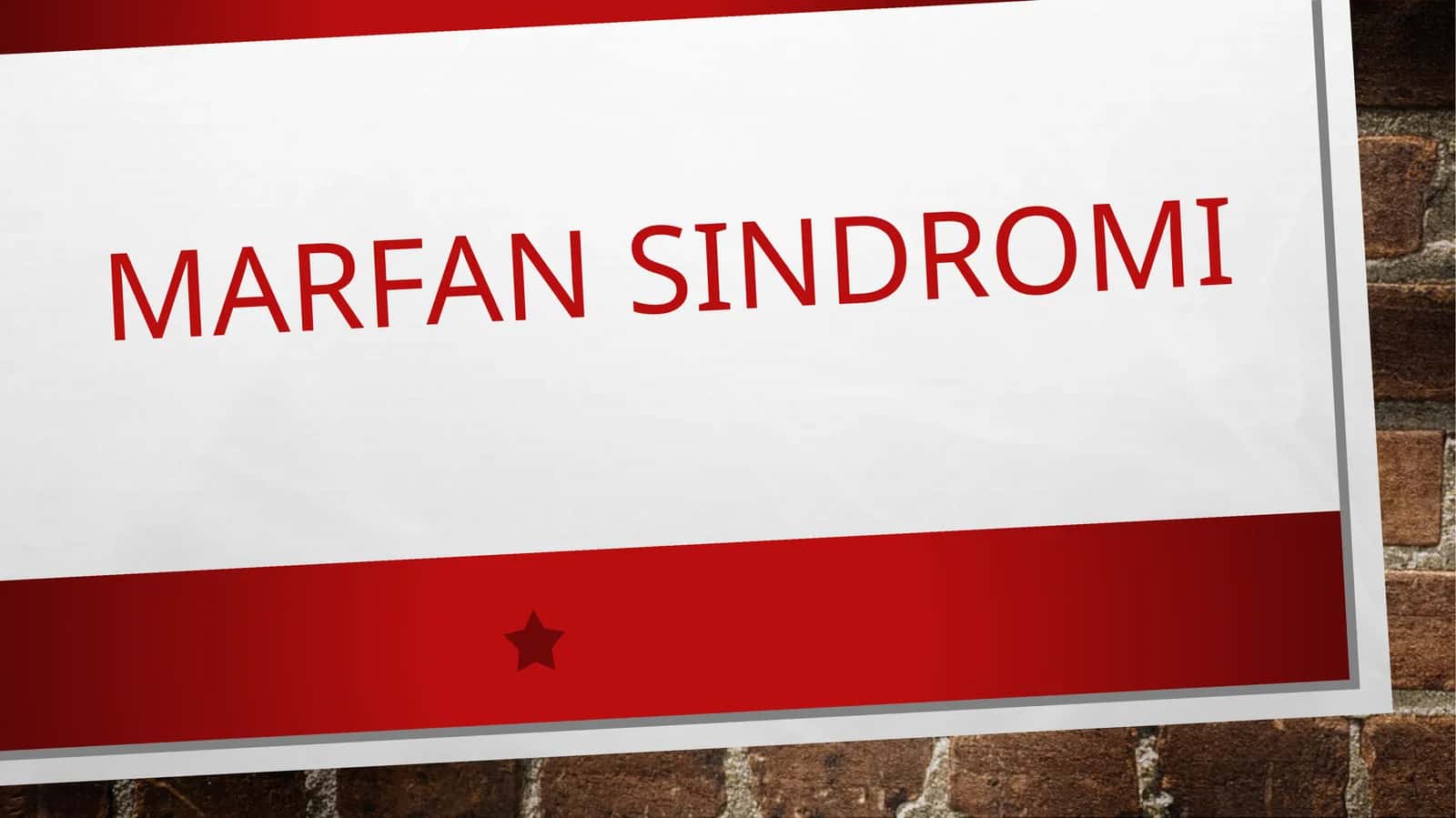 MARFAN SINDROMI 1