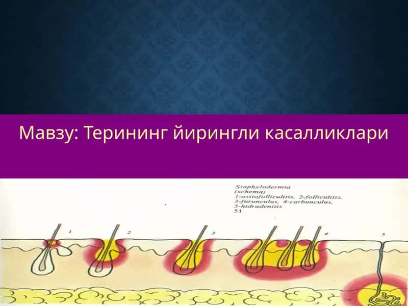 Терининг йирингли касалликлари 1