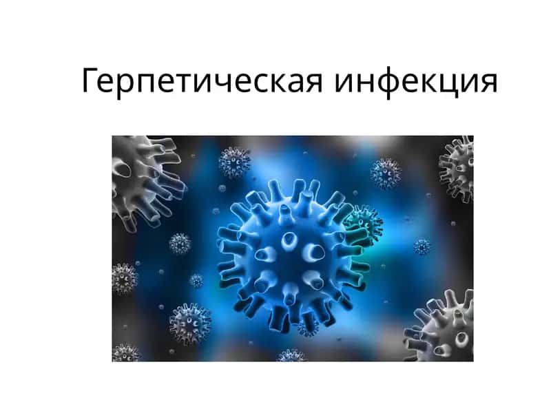 Простой герпес 1