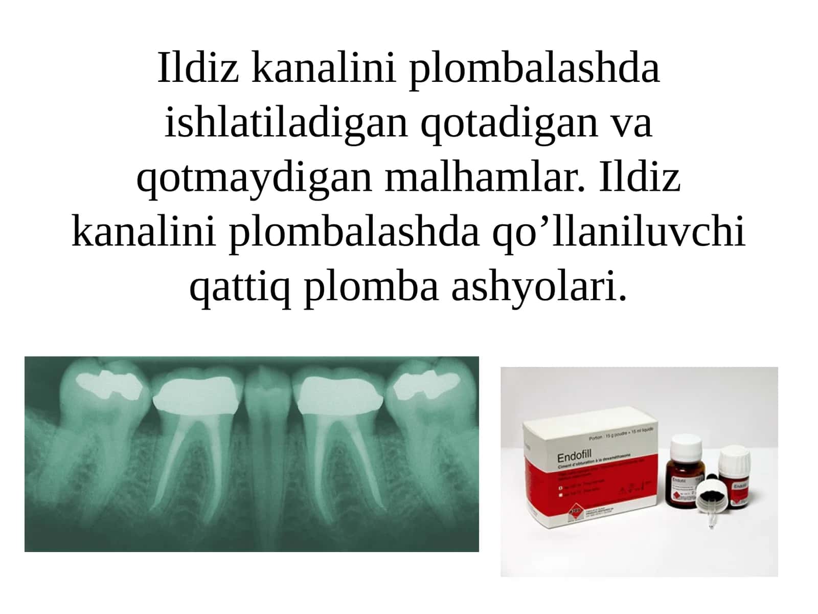 Ildiz kanalini plombalash 1
