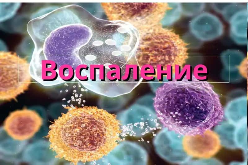 Воспаление 1