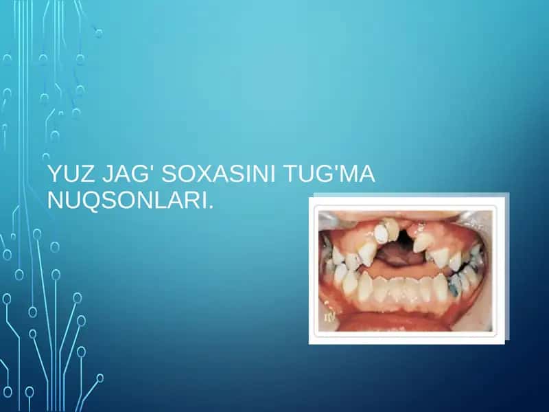 Yuzjag'soxasini tug'manuqsonlari 1
