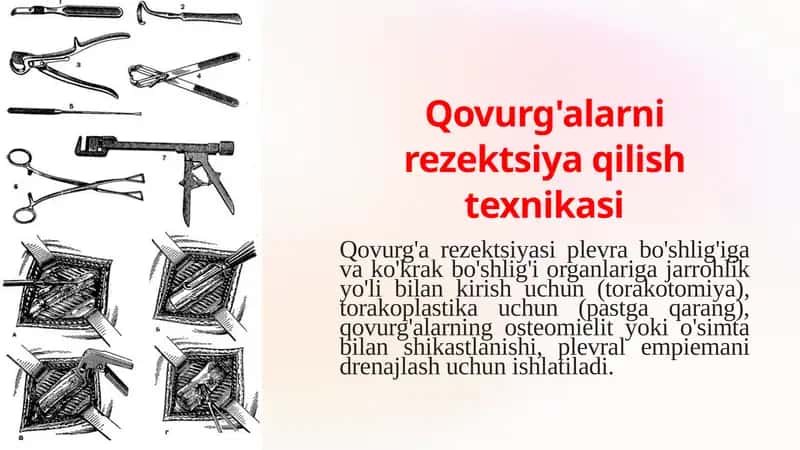 Qovurg'alar rezektsiya qilish texnikasi 1