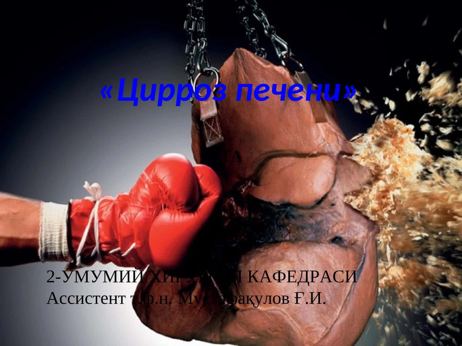 Цирроз печени 1