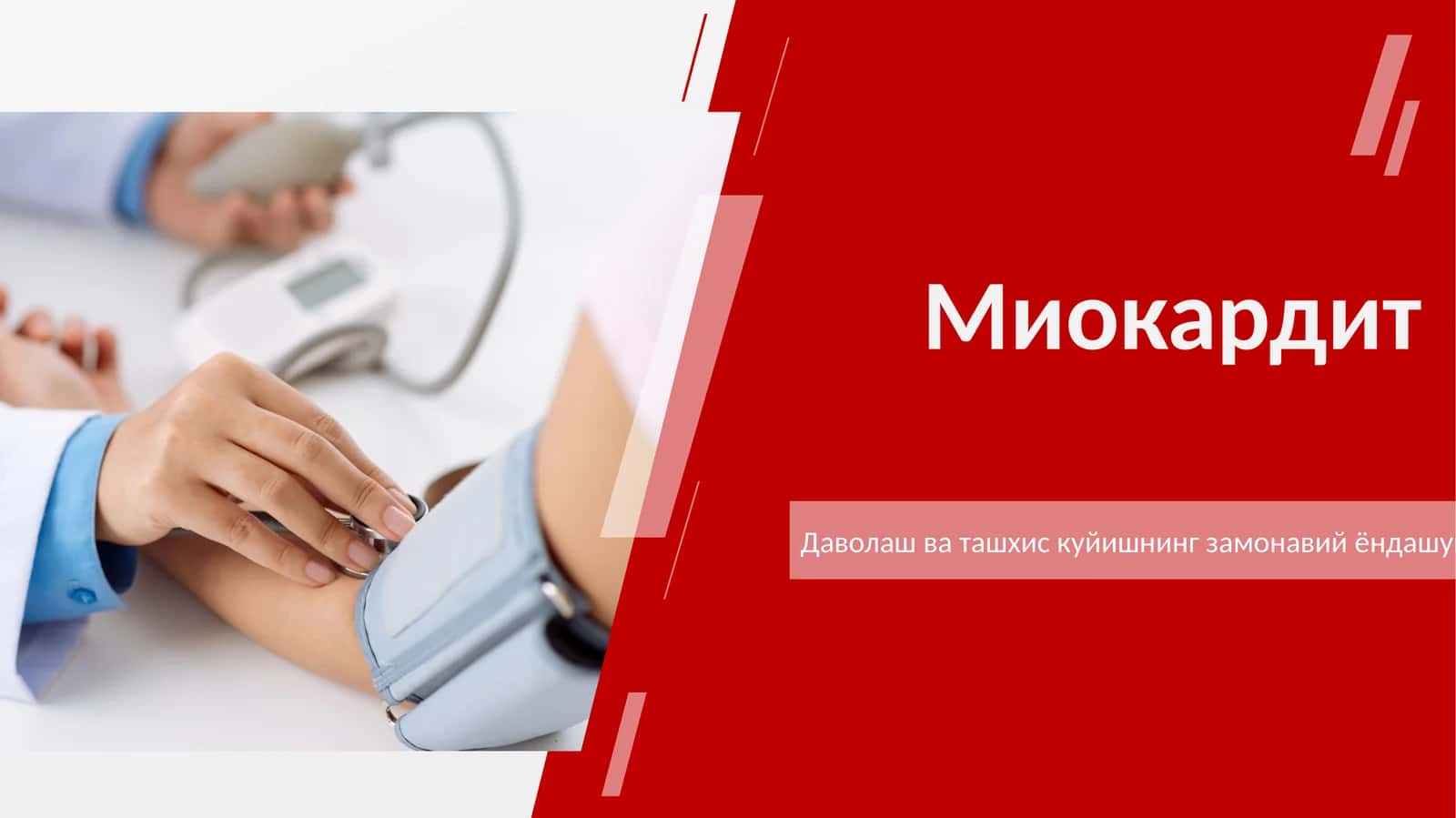 миокардит 2026 1