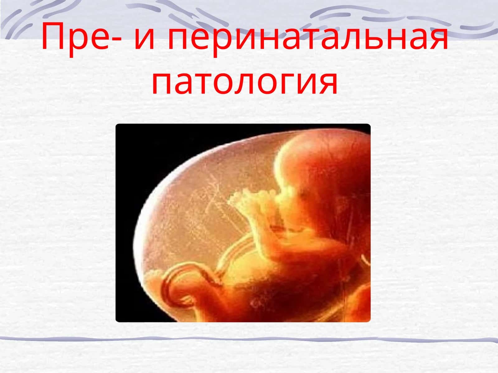 Пре- и перинатальная патология 1