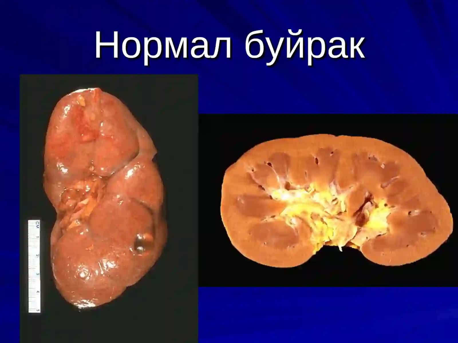 Буёқ касалликлари 2
