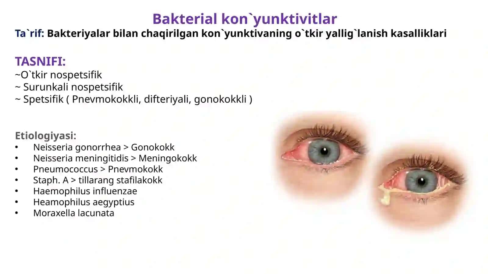 Bakterial kon`yunktivitlar etiologiyasi, klinik, diagnostika, davolash va asoratlari 2