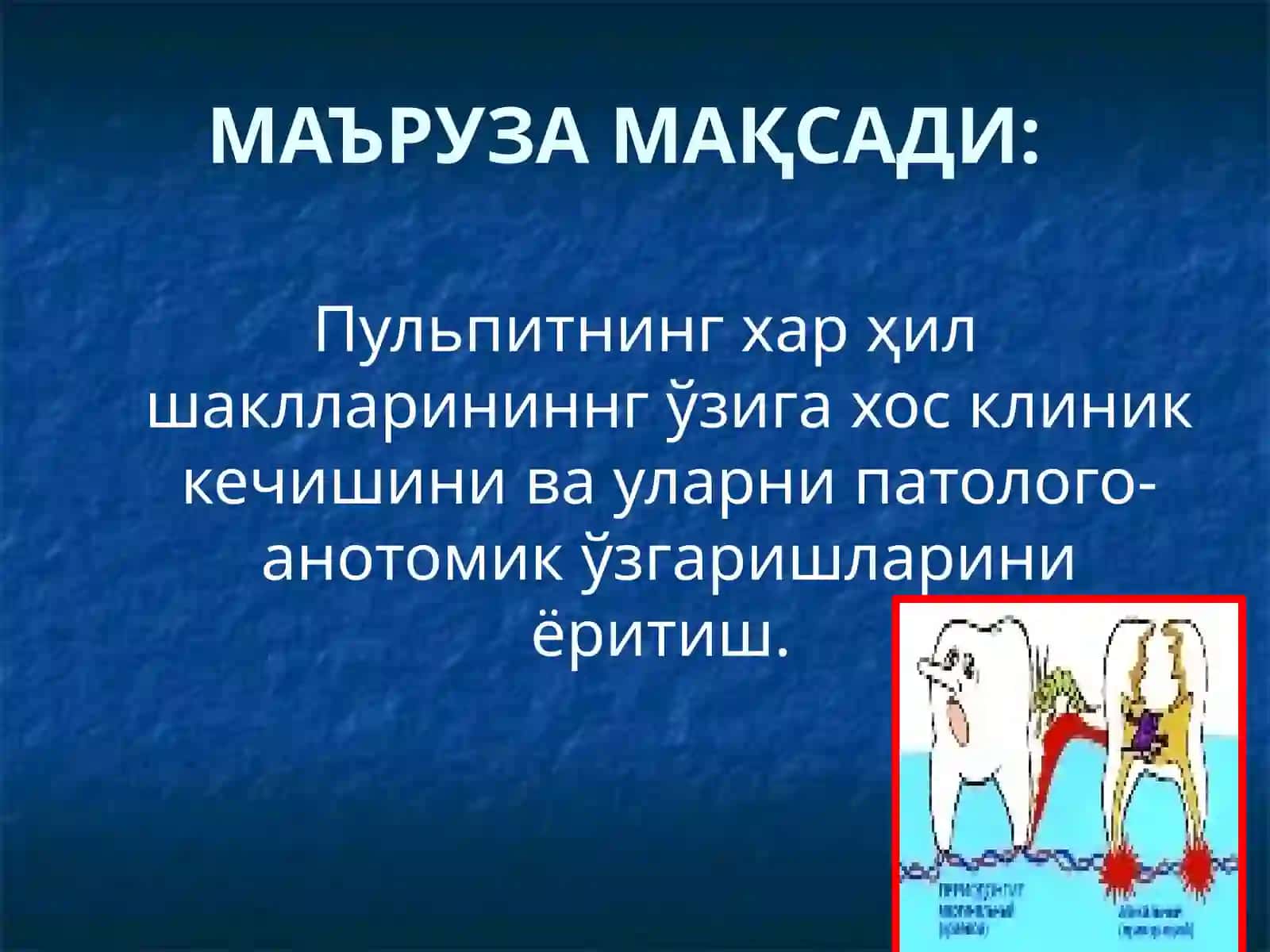 Пульпитларни клиникаси, патологик анатомияси, диагностикаси ва киёсий ташхиси 2