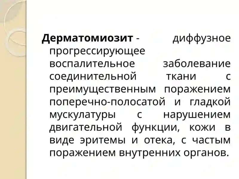 Дерматомиозит 2