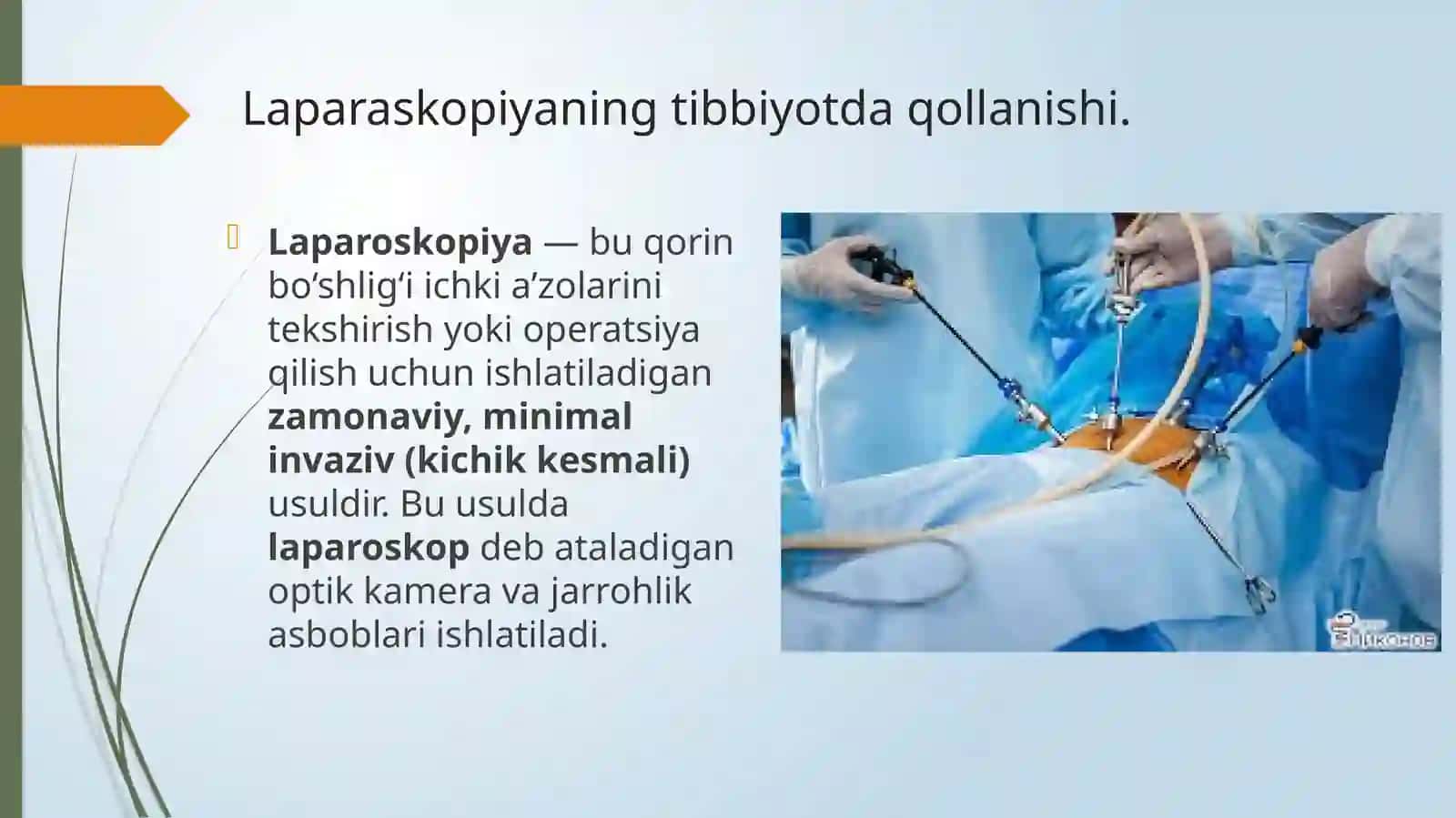 Laparoskopik herniotomiya 2